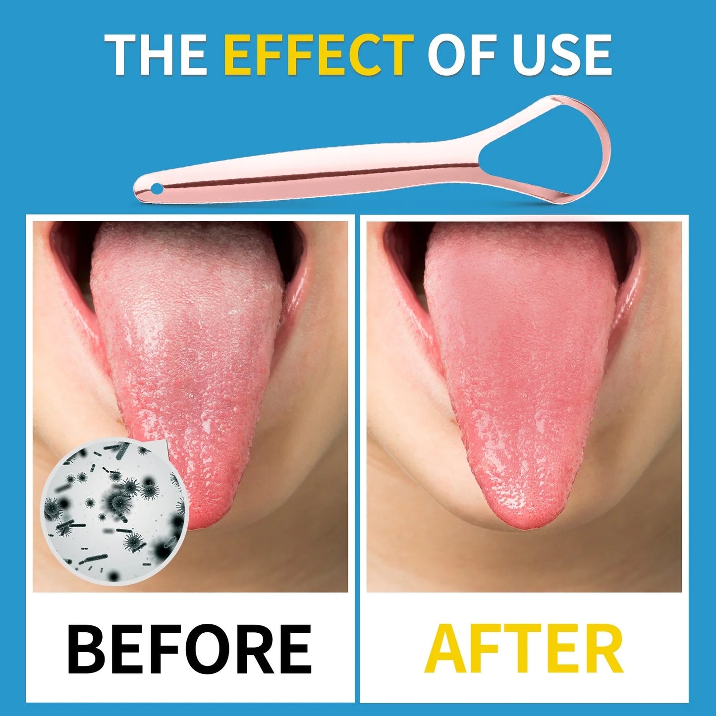Stainless Steel Tongue Scraper With Case